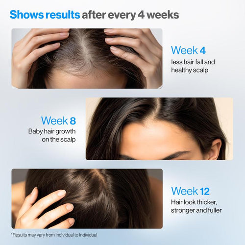 Halo Hair Growth Serum | Precision Cryo-Roller Applicator